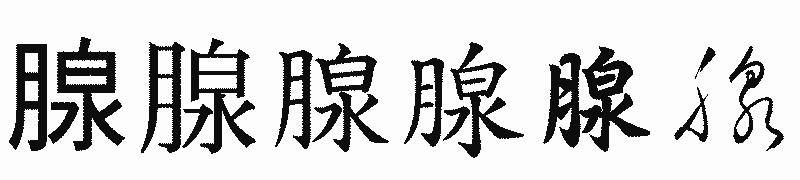 漢字「腺」の書体比較